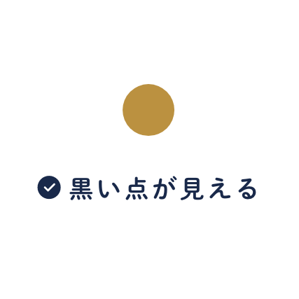 黒い点が見える